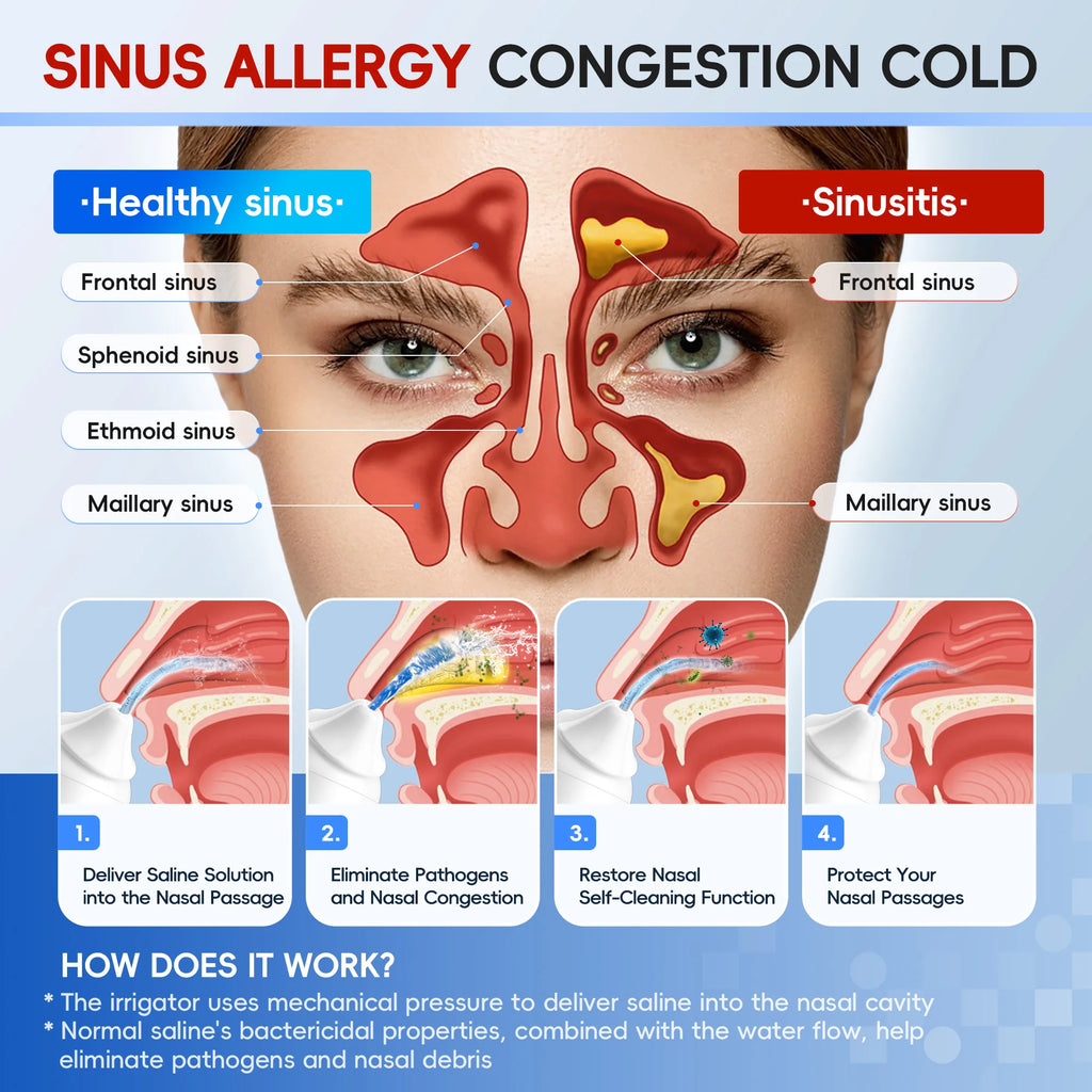 Pulsating Sinus Rinse Irrigator