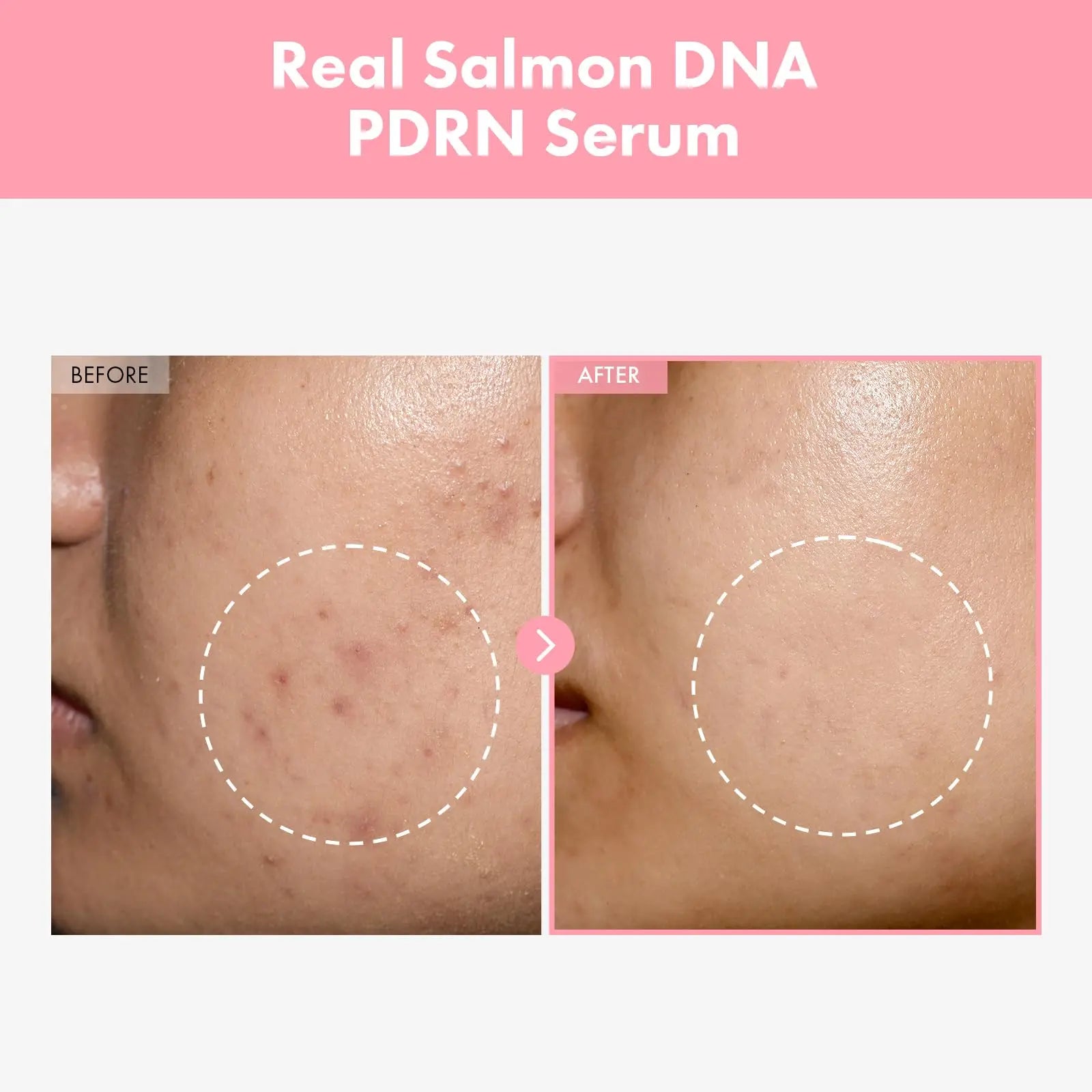 Pink Peptide Hydrolyzed Collagen PDRN Serum